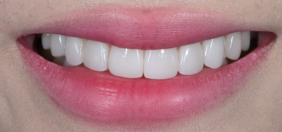 clinic case2-2.jpg
