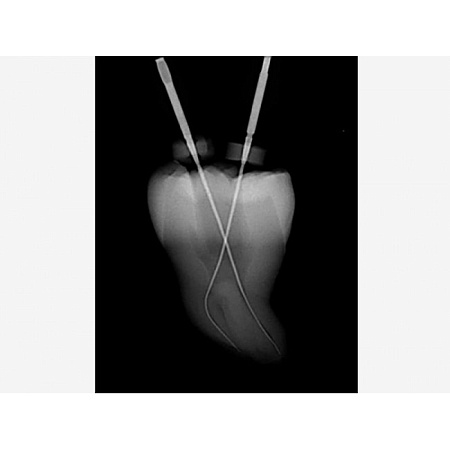 J.Morita Tri Auto ZX2 - беспроводной эндодонтический микромотор со встроенным апекслокатором