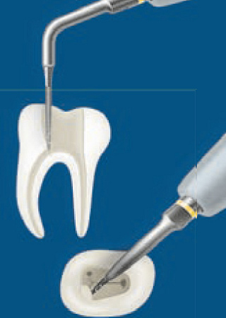 Acteon насадка ET18D – «эндо-лечение», с алмазным покрытием. Используется в канале для удаления нависающего дентина, внутриполостных кальцификаций, временных пломб и некоторых пломбировочных материалов